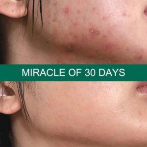 some-by-mi-aha-bha-pha-30-days-miracle-serum-4