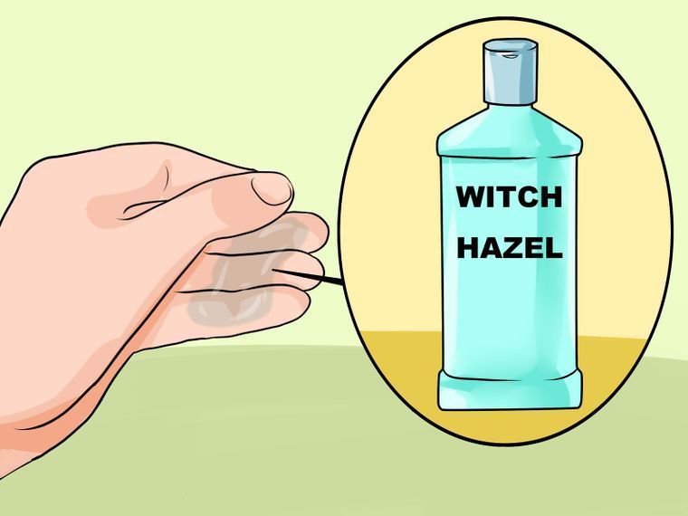 witch-hazel-2