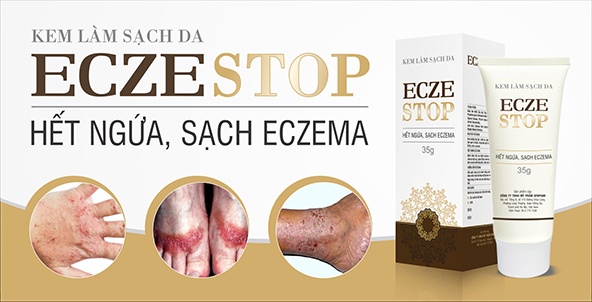 kem-lam-sach-da-eczestop-het-ngua-sach-eczema-35g-2